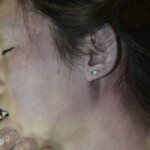 Chinese girl dead of heart attack