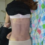 Chinese girl dead of heart attack