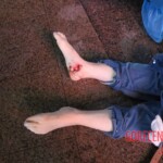 Female suicide jumper