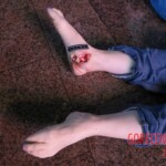 Female suicide jumper