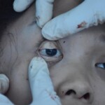 Female suicide jumper