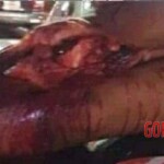 Aftermath of motorcycle accident