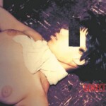 Female autoerotic asphyxiation