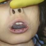 Young hanged Chinese girl