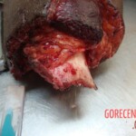 Dismembered woman in morgue