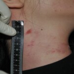 Chinese woman strangled to death