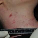 Chinese woman strangled to death