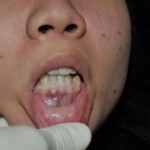 Chinese woman strangled to death