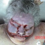 External examination of obese woman