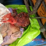 Head crushed by truck