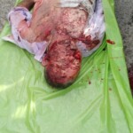 Head crushed by truck