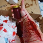 Japanese girl self-harm