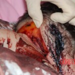 Dee Dee Blanchard crime scene photo