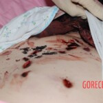 Dee Dee Blanchard crime scene photo