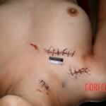 Stabbed to death by jelaous husband