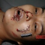 Stabbed to death by jelaous husband