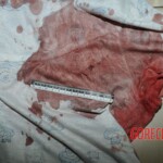Examination and autopsy of Chinese woman stabbed to death
