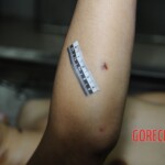 Examination and autopsy of Chinese woman stabbed to death