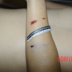 Examination and autopsy of Chinese woman stabbed to death