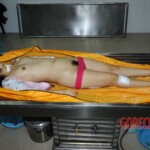 Examination and autopsy of Chinese woman stabbed to death