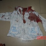 Examination and autopsy of Chinese woman stabbed to death