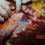 Examination and autopsy of Chinese woman stabbed to death