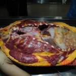 Examination and autopsy of Chinese woman stabbed to death