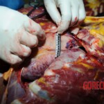 Examination and autopsy of Chinese woman stabbed to death