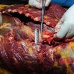 Examination and autopsy of Chinese woman stabbed to death