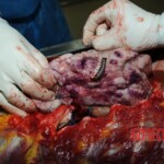 Examination and autopsy of Chinese woman stabbed to death