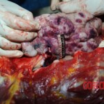 Examination and autopsy of Chinese woman stabbed to death