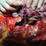 Examination and autopsy of Chinese woman stabbed to death