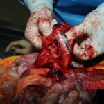 Examination and autopsy of Chinese woman stabbed to death