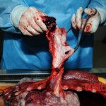 Examination and autopsy of Chinese woman stabbed to death