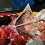 Examination and autopsy of Chinese woman stabbed to death