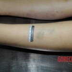 Examination and autopsy of Chinese woman stabbed to death