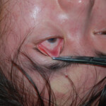 Chinese woman in morgue