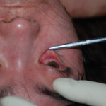 Chinese woman in morgue