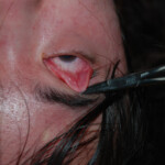 Chinese woman in morgue