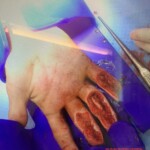 Painful work accident