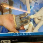 Painful work accident