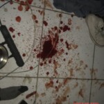 Suicide attemp by cutting wrist