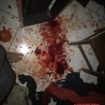 Suicide attemp by cutting wrist