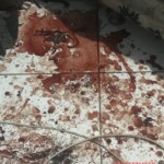 Suicide attemp by cutting wrist