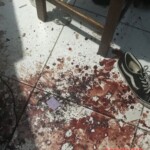 Suicide attemp by cutting wrist