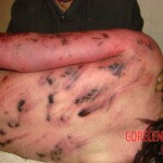 Woman in terrible condition in morgue