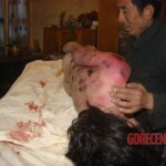 Woman in terrible condition in morgue