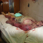 Woman in terrible condition in morgue