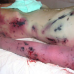 Woman in terrible condition in morgue