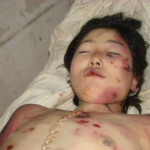 Woman in terrible condition in morgue